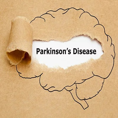 Parkinson's Disease Prediction